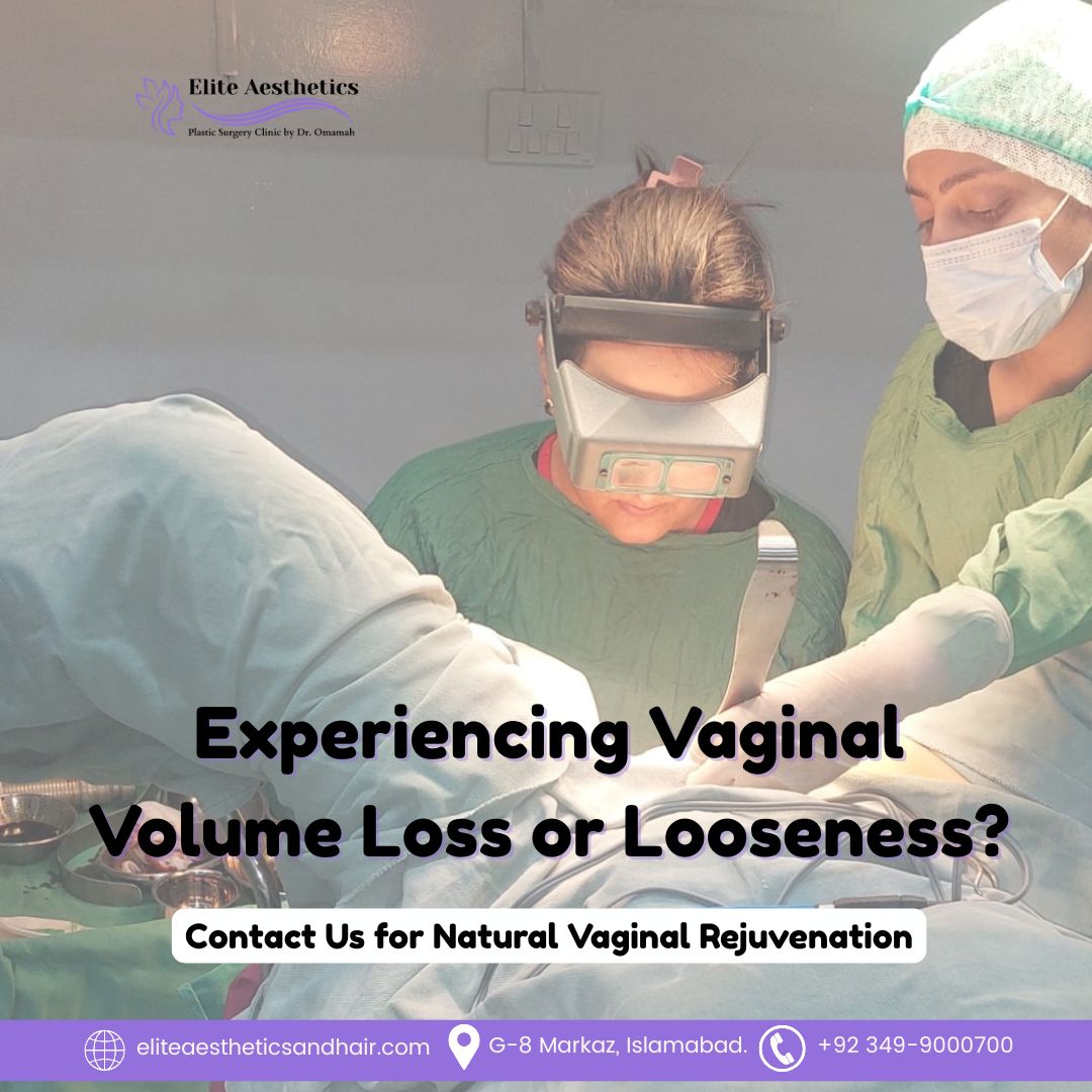 vaginal-fat-transfer